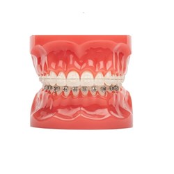 3M Typodont, Clarity Advanced Brackets Upper, Victory Series Low Profile Brackets Lower, 600-240, 1-Pack