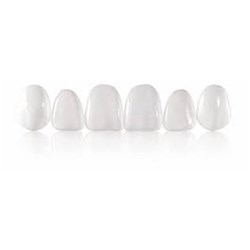 Coltene Componeer - Prefabricated Composite Shells - XL Set - 11,12,13,21,22,23 - White Opalescent Enamel, 6-Pack