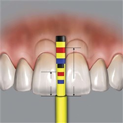 Chu's Aesthetic Papilla Refill Pack of 3