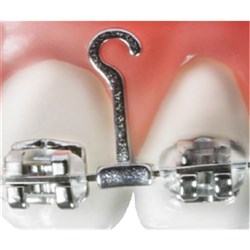 NAOL Crimpable Power Hooks, Right, 20-Pack