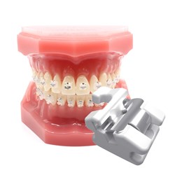 NAOL Clear Lock Ceramic MBT Bracket, 022, Active Upper & Lower 5X5 Hooks X1 Handypack Set