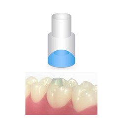 NAOL Mini-Mold Post Molar Pads, 10-Pack