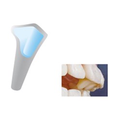 NAOL Mini-Mold 7mm Anterior Bite Jet, 8-Pack