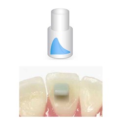 NAOL Mini-Mold Bite Ramp 5mm, 8-Pack