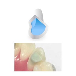 NAOL Mini-Mold Cuspid Bite Ramps Adult, 8-Pack