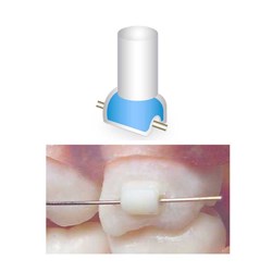 NAOL Mini-Mold Tube Bonders, 10-Pack