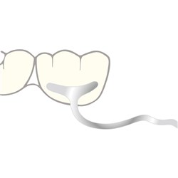 Scheu JM Clasp for Molars - 1.2mm, 10-Pack