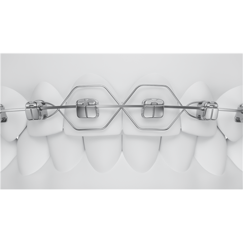 O2-102-04U24_4