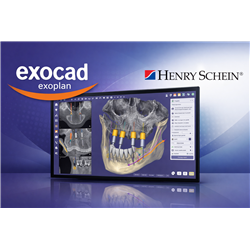 E1-BD100011IF01 - Exocad 1 Exoplan with Guide Creator Flex