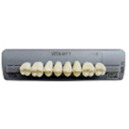 A1 Upper T46 Anterior