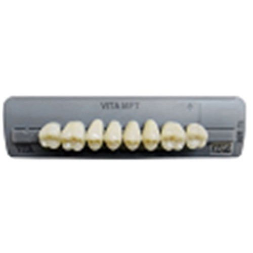 A1 T49 Upper Anterior